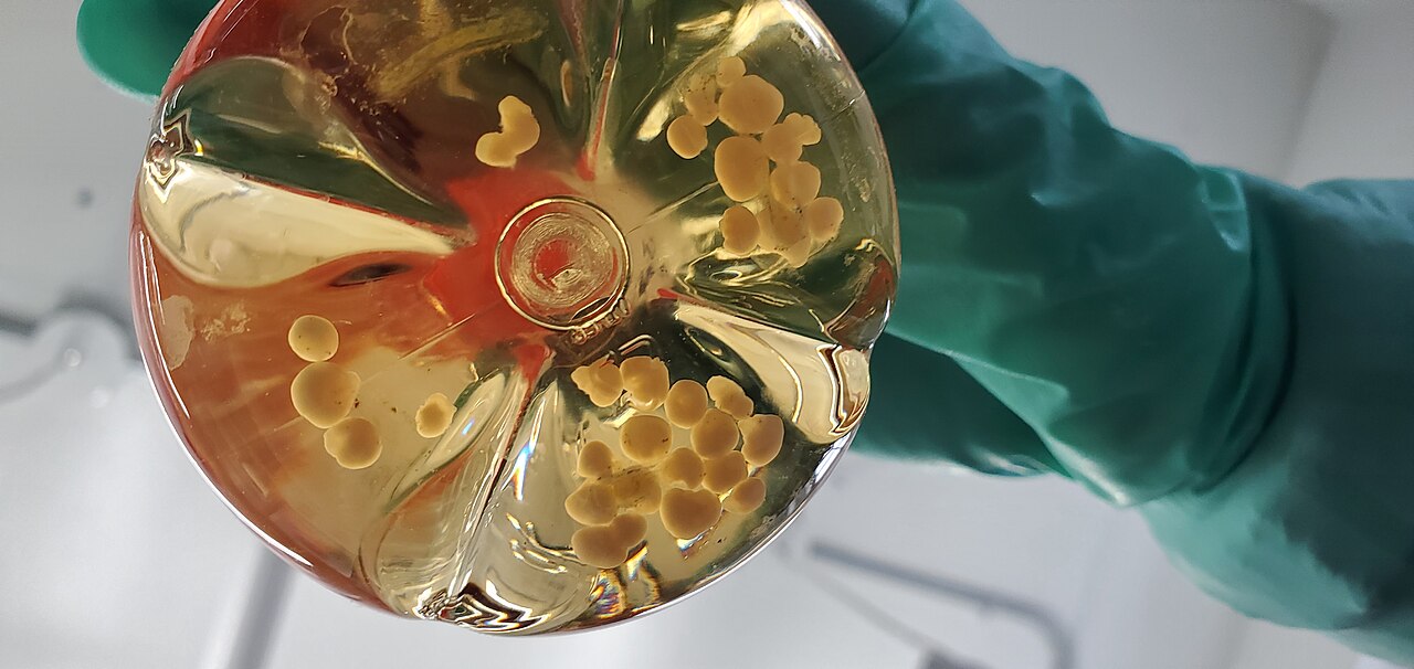Un investigador sostiene un recipiente de laboratorio con organoides cerebrales humanos en cultivo